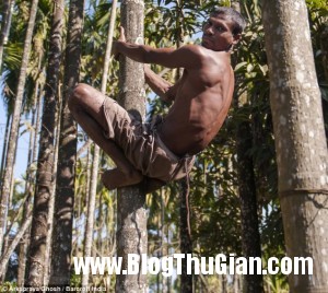 Người đàn ông mọc đuôi dài 36cm nguoi dan ong moc duoi dai 36cm 300x268 Người đàn ông mọc đuôi dài 36cm