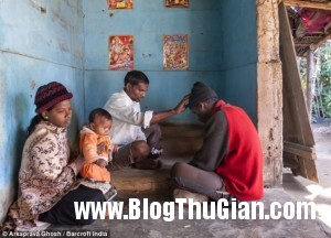 Người đàn ông mọc đuôi dài 36cm nguoi dan ong moc duoi dai 36cm4 300x216 Người đàn ông mọc đuôi dài 36cm