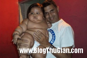 140320 2be 19790 300x200 Bé trai mới 8 tháng với cân nặng lên tới 19,5kg,