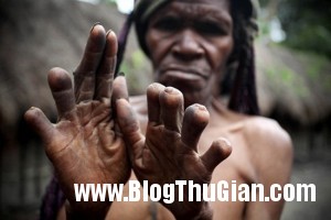 nguoiduatin images5072316 300x200 Phong tục chặt ngón tay kinh dị của bộ tộc Dani