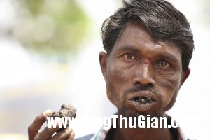 140403 2an 7fef9 300x200 Người đàn ông chỉ nghiện ăn gạch sỏi