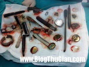140416 1nuot 181f0 300x224 Tên trộm nuốt các đồ vật do mình ăn cắp được