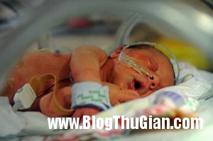 Baby Sienna 3396155 9415 1397205596 300x199 Bé mới chào đời chỉ có nửa quả tim