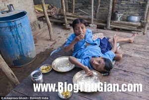 song sinh 3 300x201 Cuộc sống đầy nghị lực của hai cậu bé có thân hình dín nhau