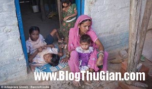 song sinh 5 300x176 Cuộc sống đầy nghị lực của hai cậu bé có thân hình dín nhau