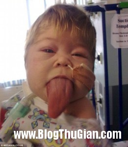 140520 1luoi 69e72 261x300 Cô bé có chiếc lưỡi như người khổng lồ