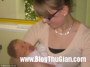 140520 2luoi 69e72 300x224 Cô bé có chiếc lưỡi như người khổng lồ