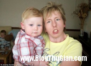 pn1 67d66 300x220 Người phụ nữ với khuôn mặt không thể mỉm cười