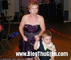 pn2 67d66 300x254 Người phụ nữ với khuôn mặt không thể mỉm cười