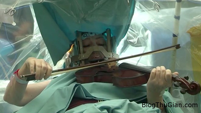 1 d2e1f Ca phẫu thuật kỳ lạ : bệnh nhân vừa phẫu thuật vừa chơi đàn
