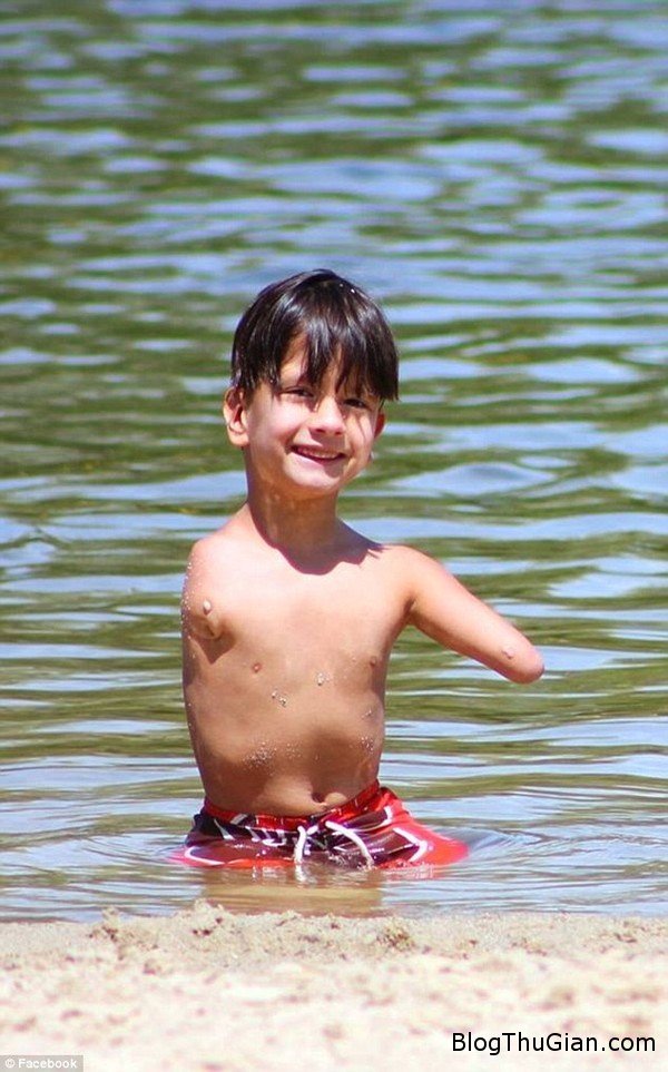 Nghị lực sống phi thường của cậu bé bị mất tứ chi 140915 2be fb589 Nghị lực sống phi thường của cậu bé bị mất tứ chi