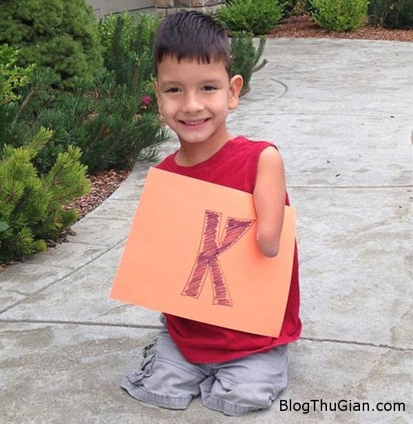 Nghị lực sống phi thường của cậu bé bị mất tứ chi 140915 3be fb589 Nghị lực sống phi thường của cậu bé bị mất tứ chi