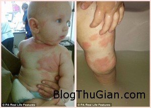 cau be di ung nang voi giang sinh 300x215 Cậu bé duy nhất sợ giáng sinh