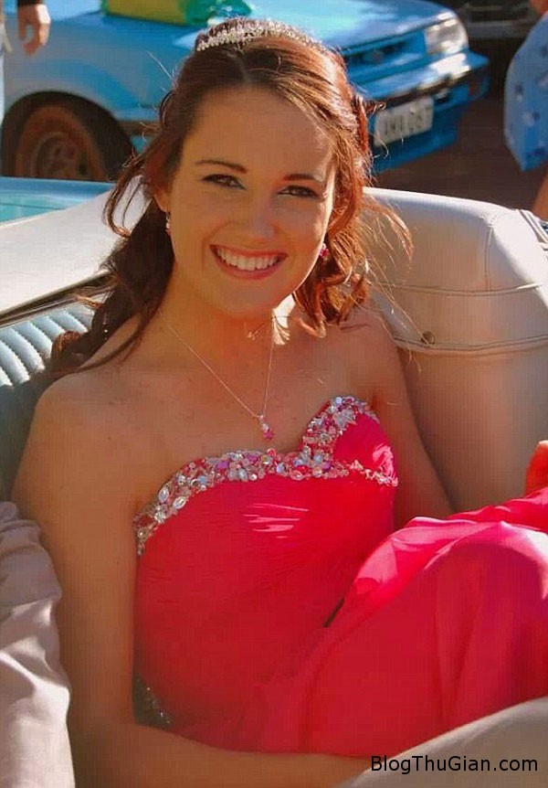 Mắc bệnh lạ da trên cơ thể cô gái xinh đẹp phồng rộp và đỏ tấy như người bị phỏng nặng mac benh la thieu nu bi troc da phong rop nhu bong nang Mắc bệnh lạ da trên cơ thể cô gái xinh đẹp phồng rộp và đỏ tấy như người bị phỏng nặng